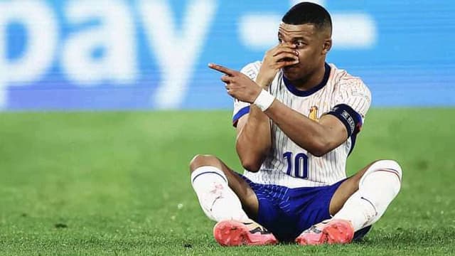 Kylian Mbappé is expected to miss France's next Euro 2024 game due to a broken nose sustained during their opening match against Australia